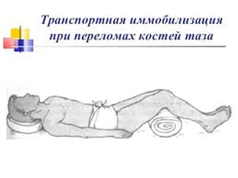 Как правильно оказать первую помощь при переломе костей таза?