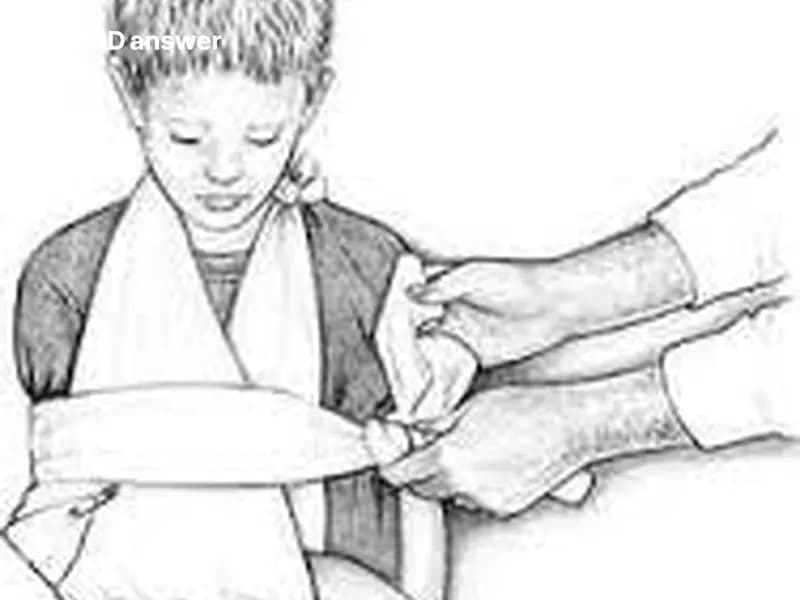 Какой повязкой можно зафиксировать согнутой к туловищу повреждённую верхнюю конечность?