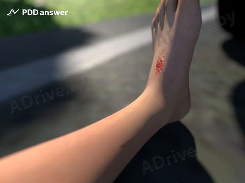 Что из перечисленного ниже является характерным признаком капиллярного кровотечения?