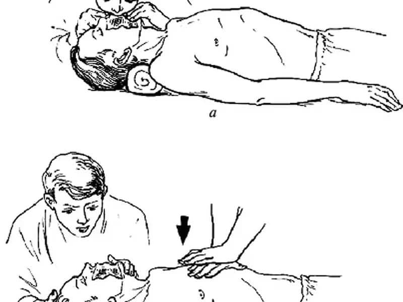 Какое правильное соотношение при выполнении реанимации (оживлении) между непрямым массажем сердца и искусственным дыханием, если первую помощь оказывают два человека?