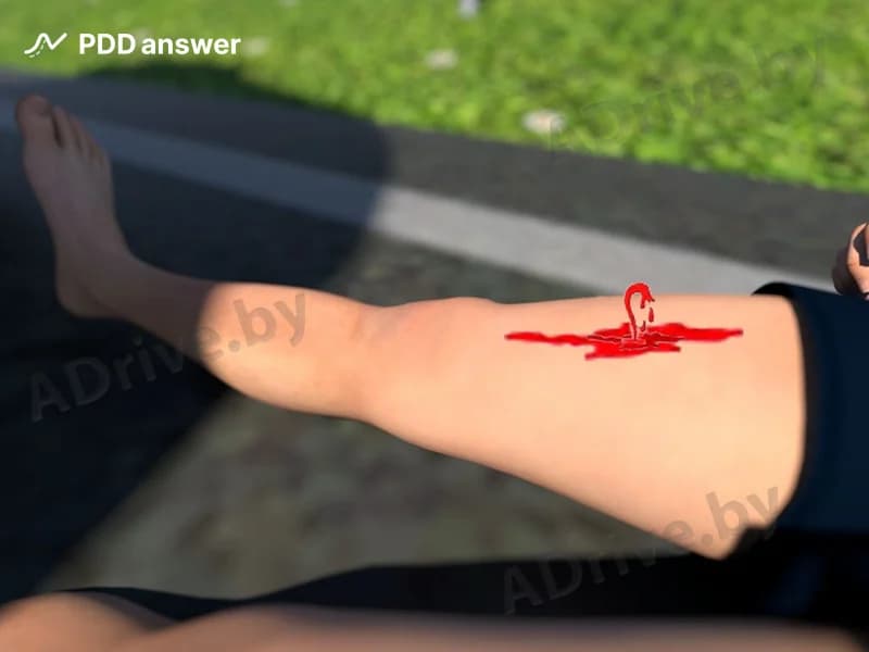 Какие из перечисленных признаков являются характерными для артериального кровотечения?