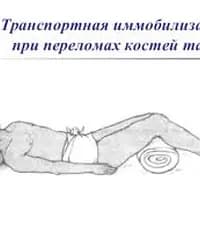 Как правильно оказать первую помощь при переломе костей таза?